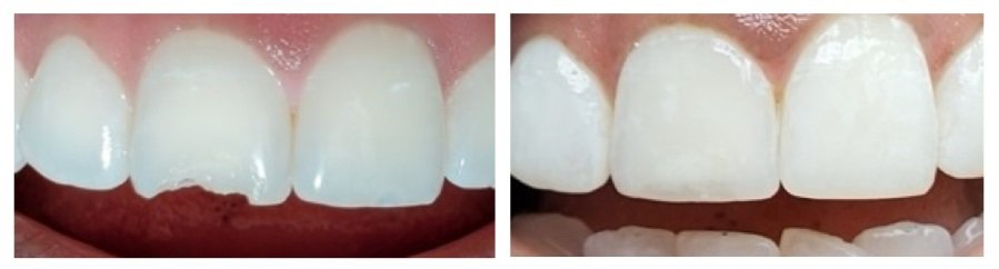 Transform your smile for the New Year