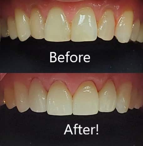 Small Cosmetic dental tweaks work wonders